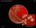 klebsiella pneumoniae in Petri dish on blood agar with non-hemolytic colonies